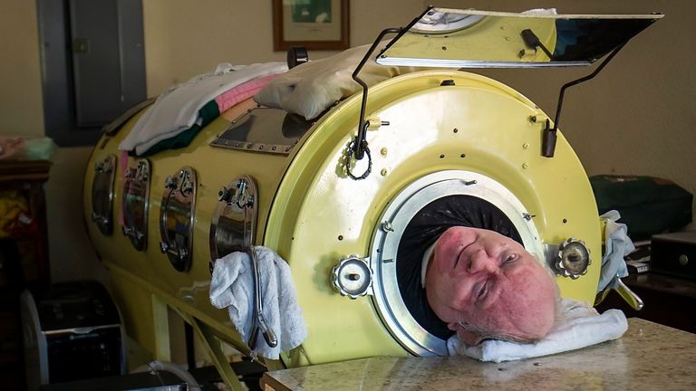 Paul Alexander: ``The Man with the Iron Lung'' dies at age 78.